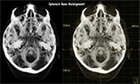 X-Ray image cranium
